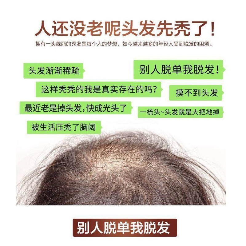 Natural Zenshow Ginger Hair Loss Shampoo Serum Control Oil Strong