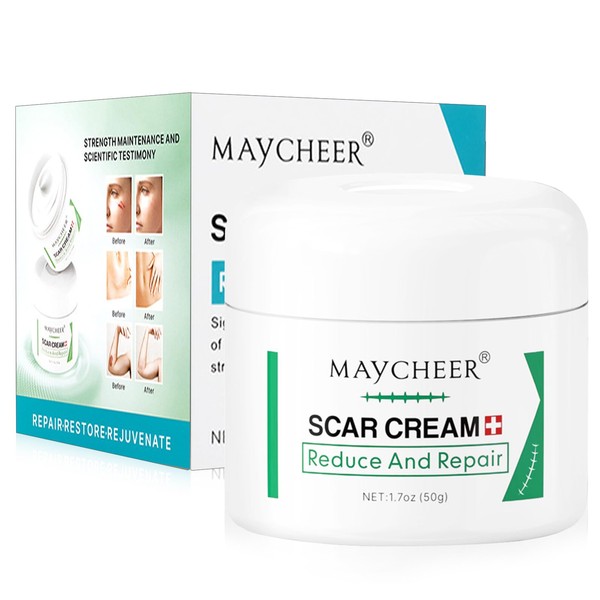 Scar Cream, Scar Ointment, Stretch Mark Cream, Scar Remove Cream