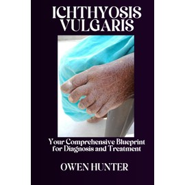  Ichthyosis Vulgaris: Your Comprehensive Blueprint for Diagnosis and Treatment