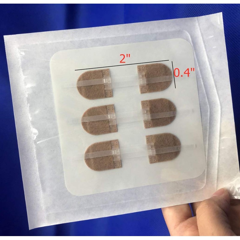 Emergency Wound Closures Adhesive Bandages, Zip Stitch Stickers for Camping,