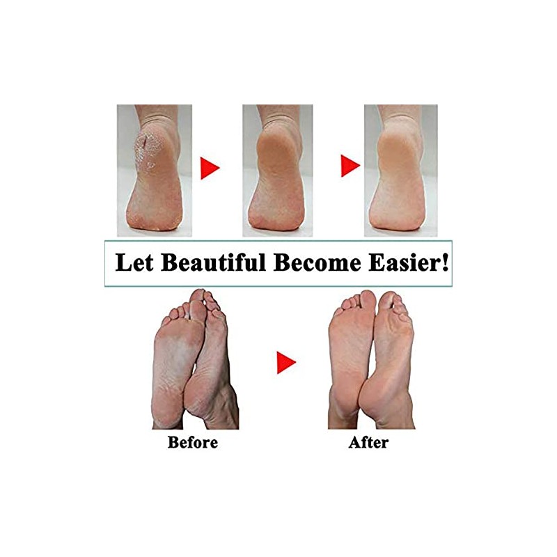 Hsthe Sea 4 Pack Extra Coarse Mineral Replacement Rollers Mineral