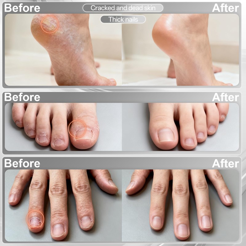 Electric Nail File Drill, Cordless 2000 mAh Rechargeable Nail Filer