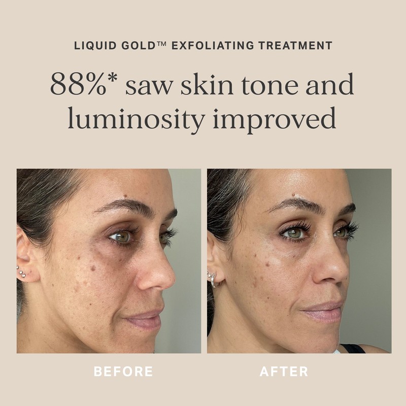 Alpha-H Liquid Gold Exfoliating Treatment with 5% Glycolic Acid 100ml