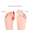 2Pcs zehentrenner,Gel-Zehenspreizer,Silikon Zehen Abstandhalter für überlappende Zehen
