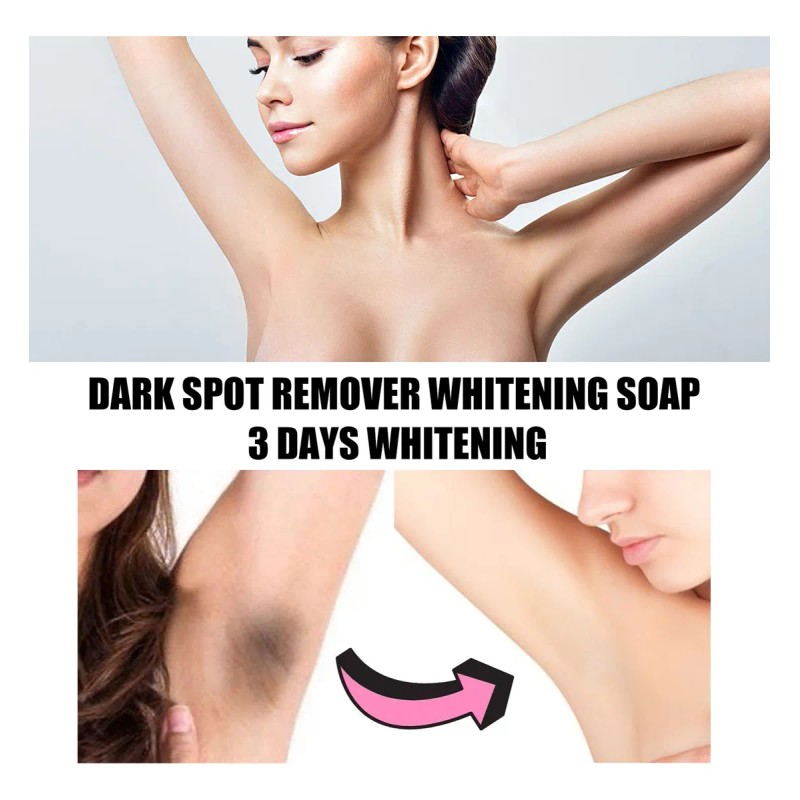 Jabón L Darkspot Whitening, Blanqueador De Axilas, Barra Ava