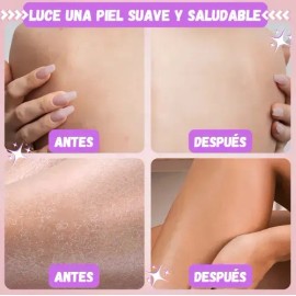 Exfoliante Corporal Piel Suave Ultramo Nutritivo Hidratante Piña