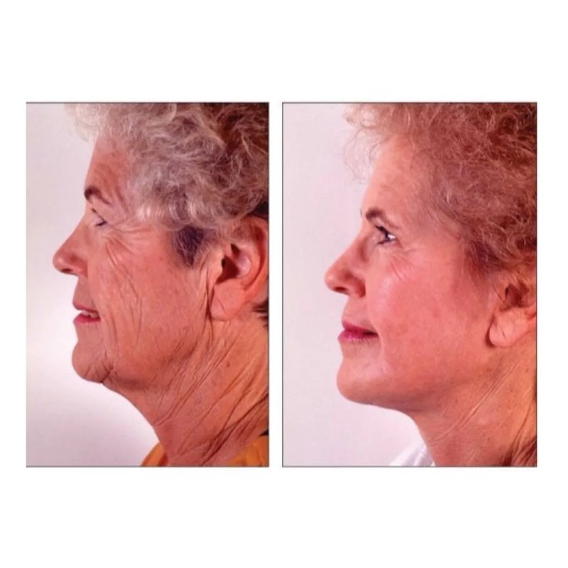 Skindulgence Mascarilla Rejuvenece En 30 Minutos