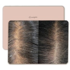 3PCS/Pack Scalp Micropigmentation Practice Skin – Printed SMP Tattoo Training Pad for Hairline Design & Dot Work – Ideal for Beginners & Artists (3PCS Design #3)