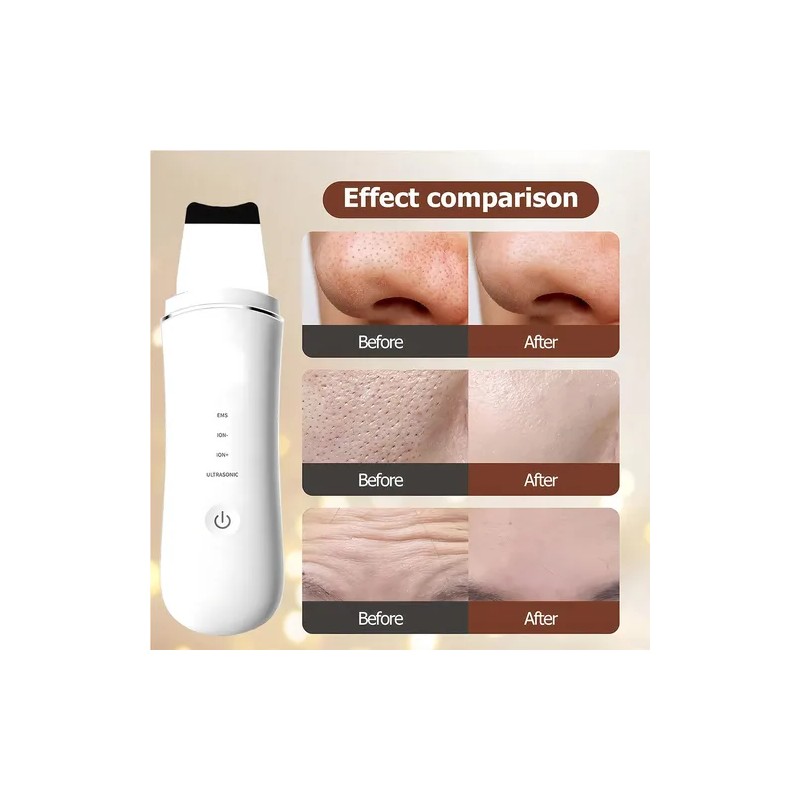 Limpiador Facial Peeling Ultrasónico Portatil Skin Scrubber