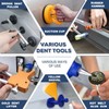 ROADGIVE Auto Body Dent Repair Tools, 75PCS Paint-Friendly Dent Removal