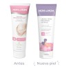 Crema Corporal Mom To Mom Prevenir Estrías Etapa A 250ml