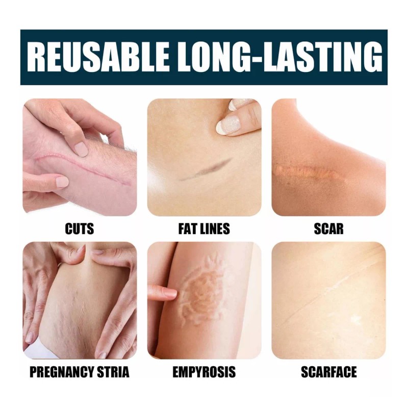 Jaysuing Crema/gel Para Cicatrices Profundas,marcas, Cacarizos