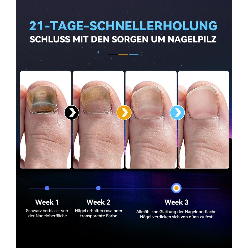 Nail pil laser device, 7 days fast acting, with time