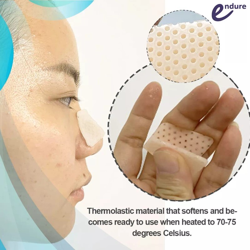 Endure Industries Thermoplastic Nasal Splints, Nose External Protector for Nose