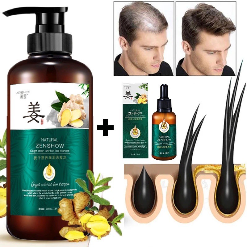 Natural Zenshow Ginger Hair Loss Shampoo Serum Control Oil Strong