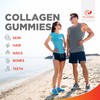 Collagen Complex Gummies for Women & Men, 500mg Collagen with