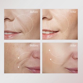 Retinol Skin Booster Serum,Retinol Serum for Face,Vita A Retinal Shot Tightening Booster,Korean Anti-Aging Serums for Wrinkles,Smoother & Firmer Skin,for Wrinkles & Fine Lines,Improve Elasticity