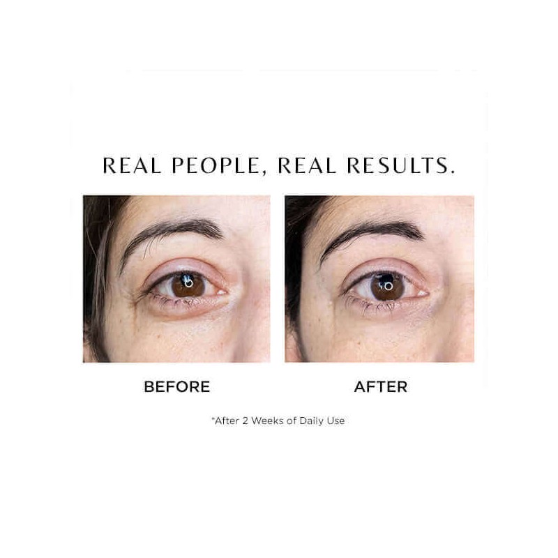 Cosmedix Elite I-Complex 10ml