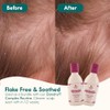 Nature Spell Dandruff Complex Travel Size Duo, Shampoo & Conditioner