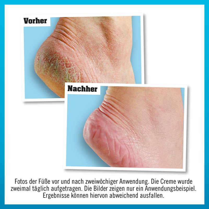 O'Keeffe's Healthy Feet Foot Cream, 85 ml