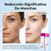 Arbutina 7% y Ácido Tranexámico 4% Face Cream
