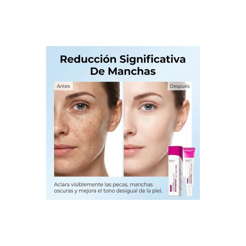 Arbutina 7% y Ácido Tranexámico 4% Face Cream