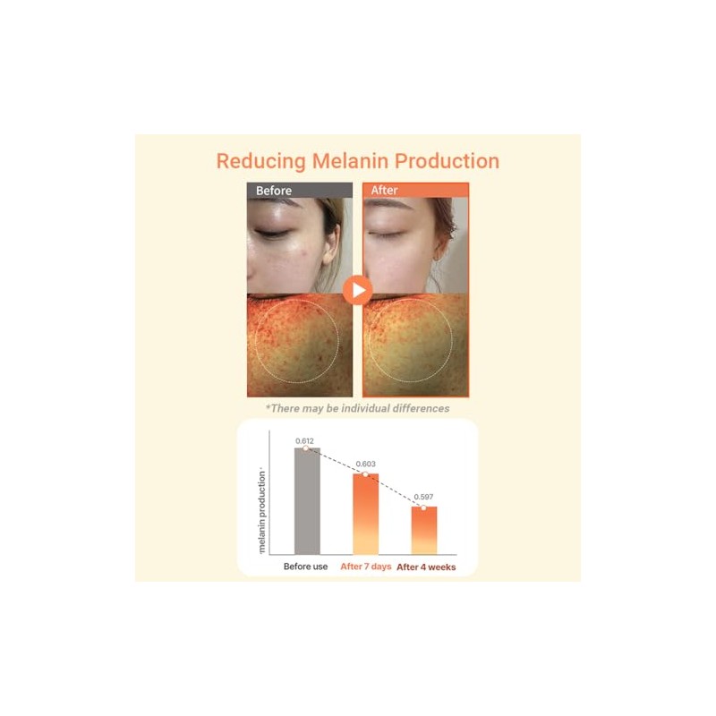 HEIMISH RX MULTI VITAMIN DARK SPOT CREAM