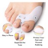 Kit 23 Piezas Corrector Juanetes Separadores Silicona Para Dedos Pie