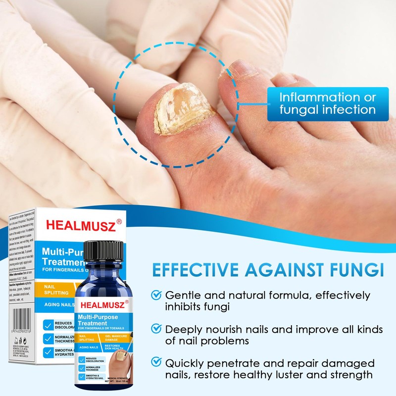 30 ml Nail Building Serum Toenail Treatment, Nail Repair, Nail