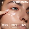 5% Caffeine Eye Cream for Dark Circles Under Treatment Eye