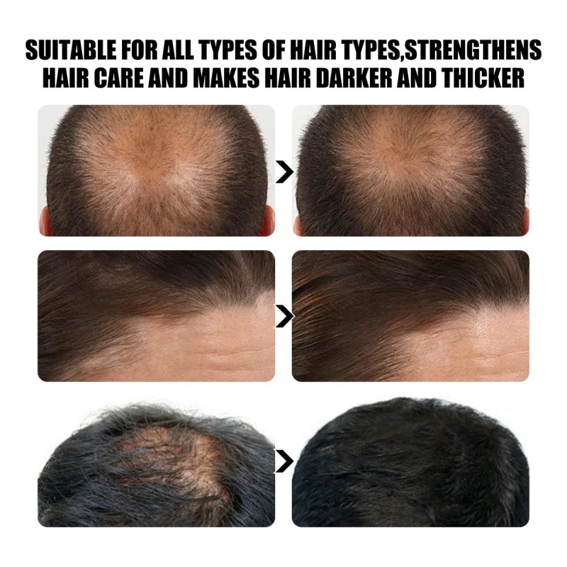 Champú Para El Crecimiento Del Cabello, Champú Spartan