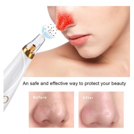 Kit Eliminador Puntos Negros, Extractor Acné Y Espinil