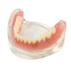 Dental Model Overdenture Inferior 4 Implants Demo Mandibular Model for