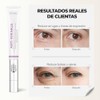 Seyoul Crema de Ojos Hidratante Con Pptidos, cido Hialurnico y