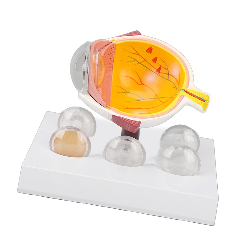 Enlarged Human Eye Anatomical Model Accurate Shows Optic Nerves Cornea