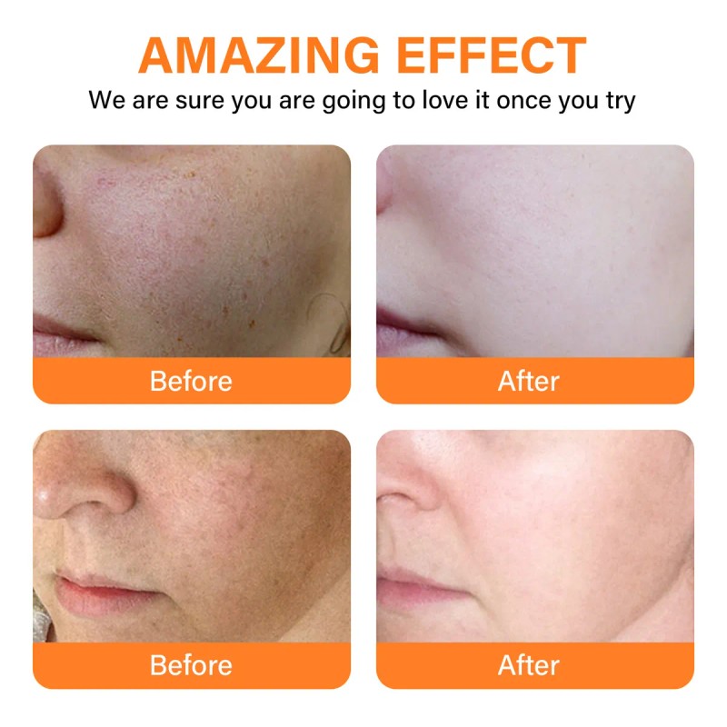 Vitamin C Boosting Serum,apto Para Todo Tipo De Pieles 2pcs