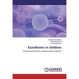Exanthems in children: Clinical manifestation, diagnosis and treatment