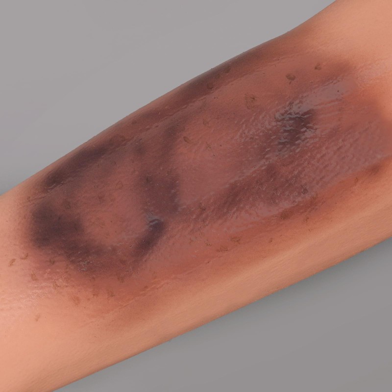 MedEduQuest Bruise Wound Care Training Sleeve, Wound Packing Trainer for