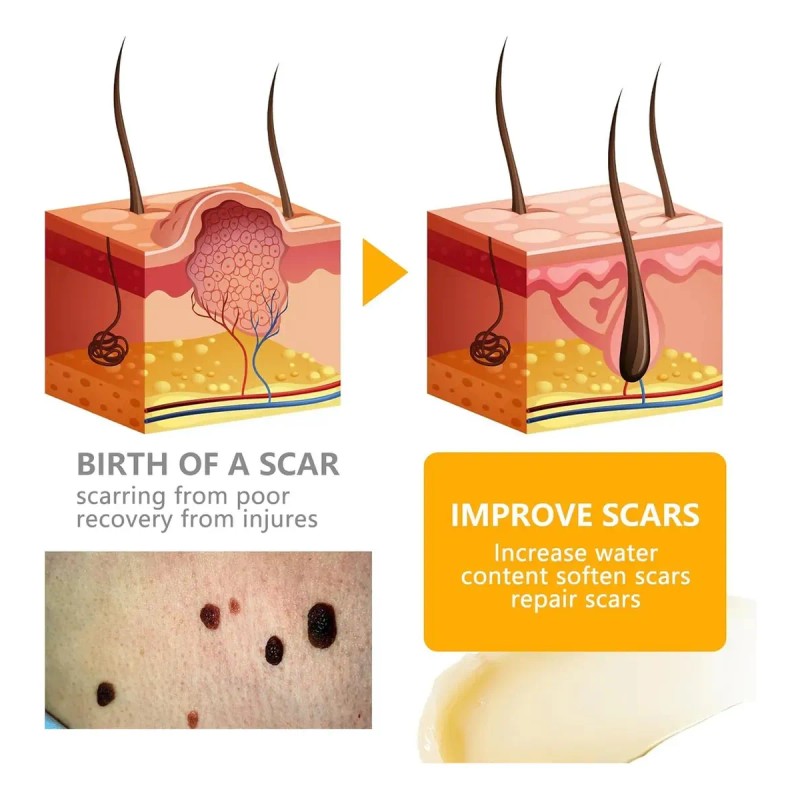 Crema Para El Cuidado De La Piel, Reduce Todo Tipo