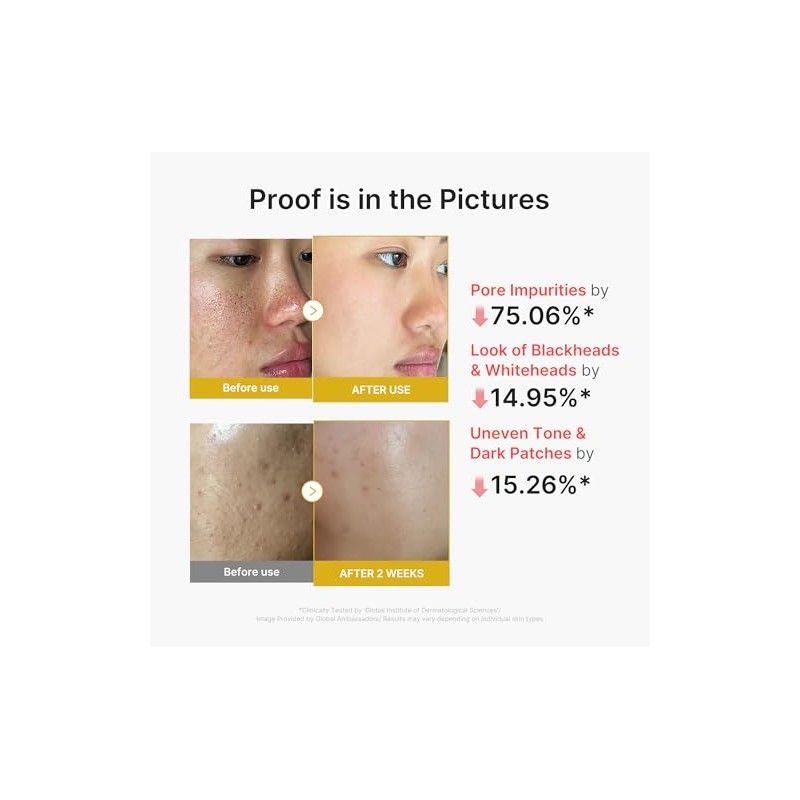 Medicube Peel Shot With Kojic Acid Turmeric Reset One Step
