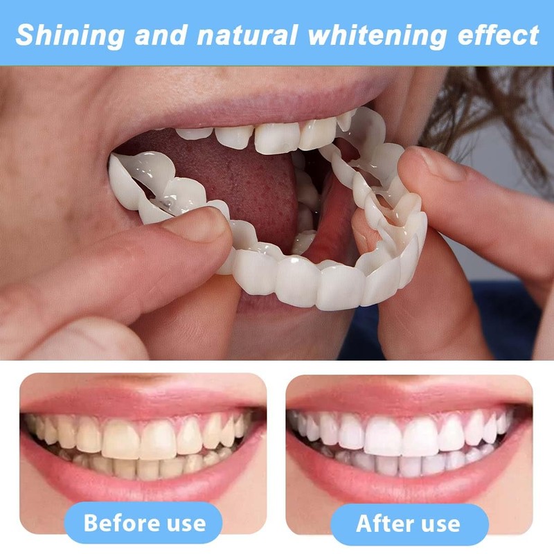 Teegxddy 4 Pairs Instant Veneers Dentures,Clip on Veneers Top and