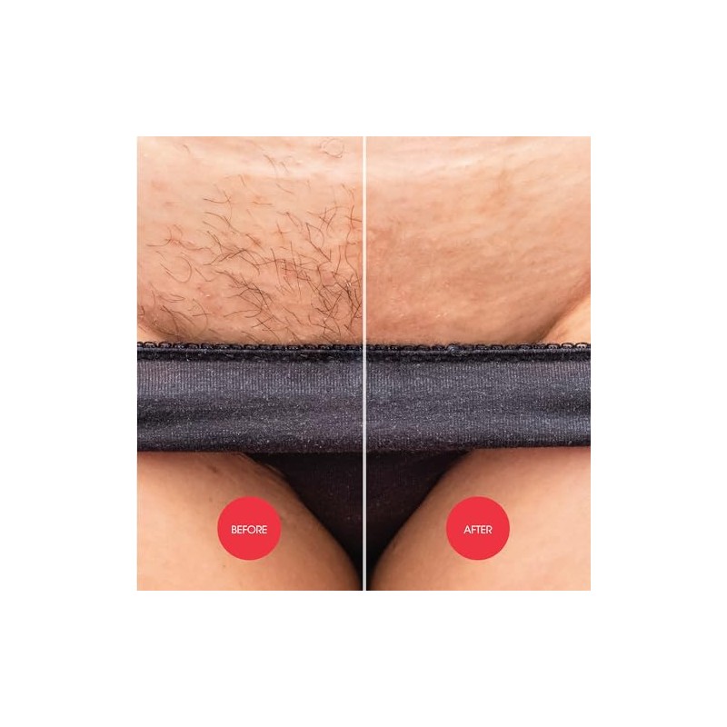 Nad's Down Under Cream for Women, Intimate Hair Removal Cream