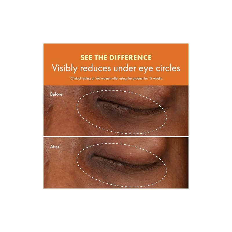 Origins Ginzing Refreshing Eye Cream To Brighten and Depuff By