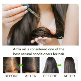Aliver Aceite De Amla Control Caída Fortalece Folículos Capilares