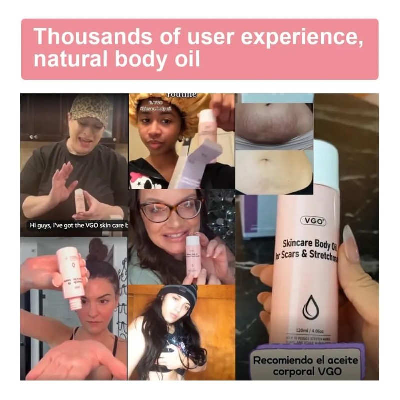 Vgo Women Skin Care Body Oil Eliminación De Cicatrices Adecu
