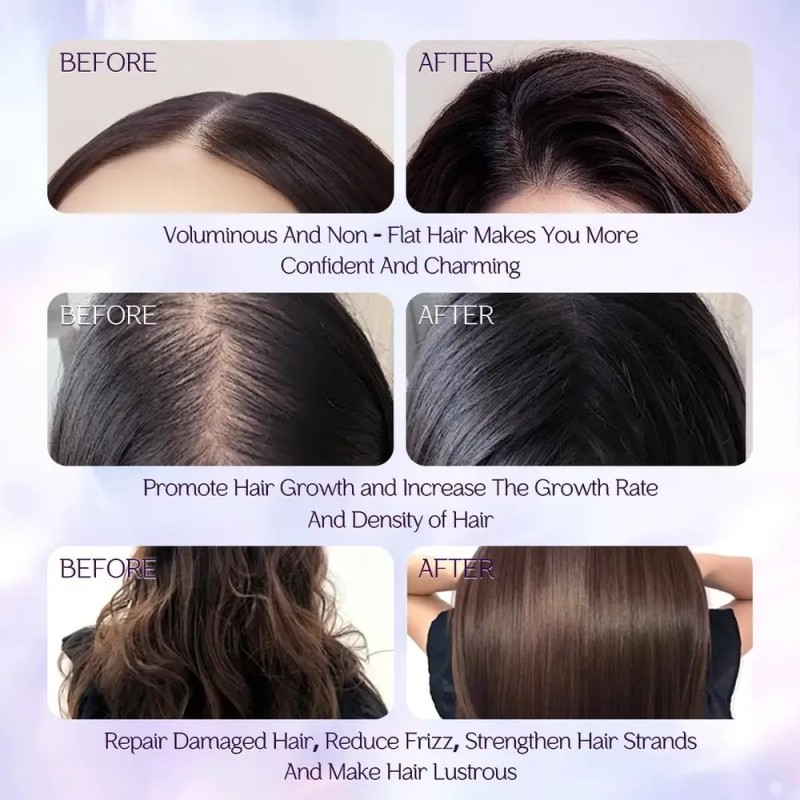 Aceite De Batana Para El Crecimiento Del Cabello, 100% Puro