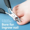 Toe Nail Clipper for Ingrown or Thick Toenails,Toenails Trimmer and