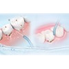 YanBan 2pcs Dental Water Jet Tips Refills for Waterpik, Replacement
