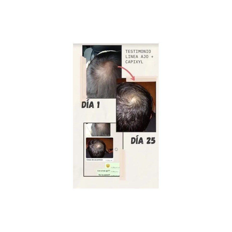 Set Reviving Tratamiento Para El Crecimiento Del Cabello