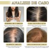 Aceite Natural Para el Crecimiento del Cabello, Aceite Orgánico De